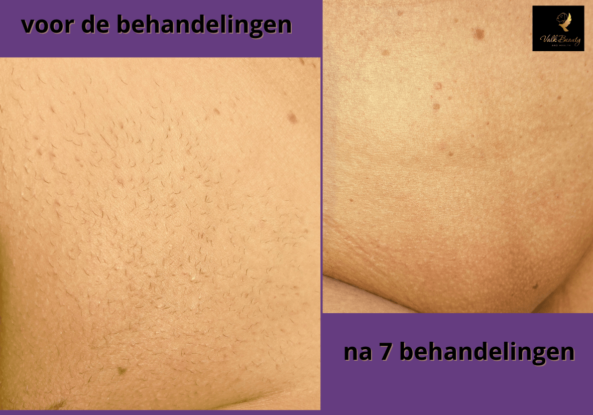 Ontwerp zonder titel 17
